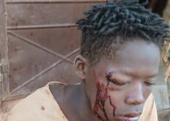 Attaque à main armée à Siguiri : bilan provisoire de 4 blessés