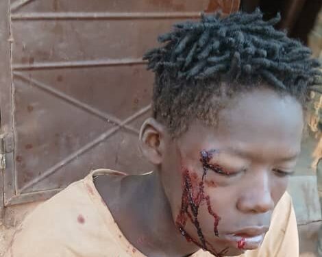 Attaque à main armée à Siguiri : bilan provisoire de 4 blessés